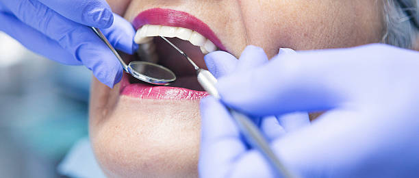 Best Emergency Root Canal Therapy in Walled Lake, MI